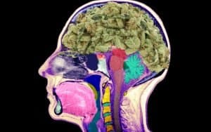 is cannabis good for your brain?
